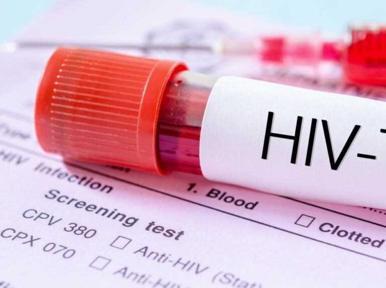 LSACA Clarifies Lagos’ 10,430 HIV Cases Are Diagnoses, Not New Infections